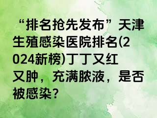 “排名抢先发布”天津生殖感染医院排名(2024新榜)丁丁又红又肿，充满脓液，是否被感染？