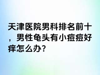 天津医院男科排名前十，男性龟头有小痘痘好痒怎么办？