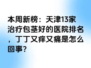 本周新榜：天津13家治疗包茎好的医院排名，丁丁又痒又痛是怎么回事？